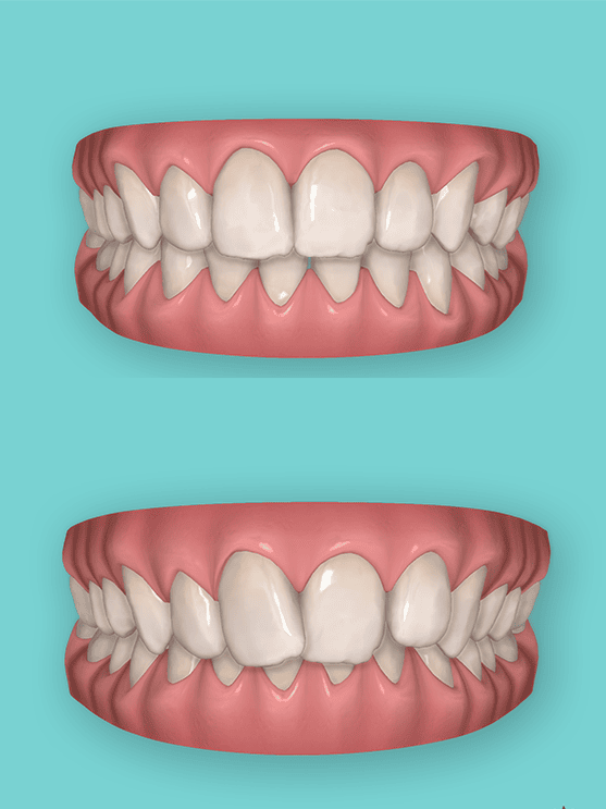 3D Behandlungsplanung