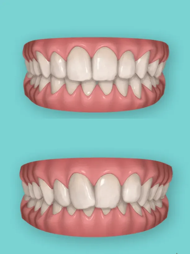 3D Behandlungsplanung